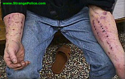 fetaci4